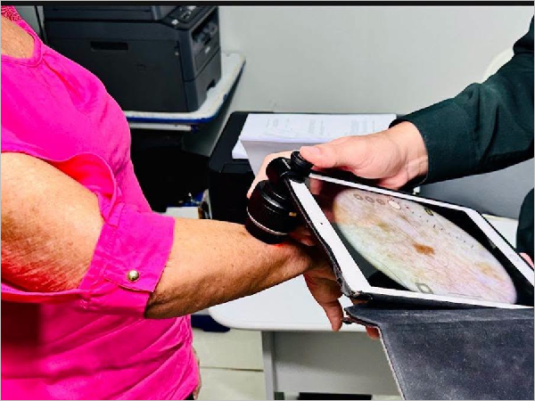Poranga amplia acesso à saúde especializada com atendimento dermatológico